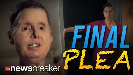 FINAL PLEA: Woman Mauled and Disfigured in Chimp Attack Pleads Lawmakers to Allow $150M Suit