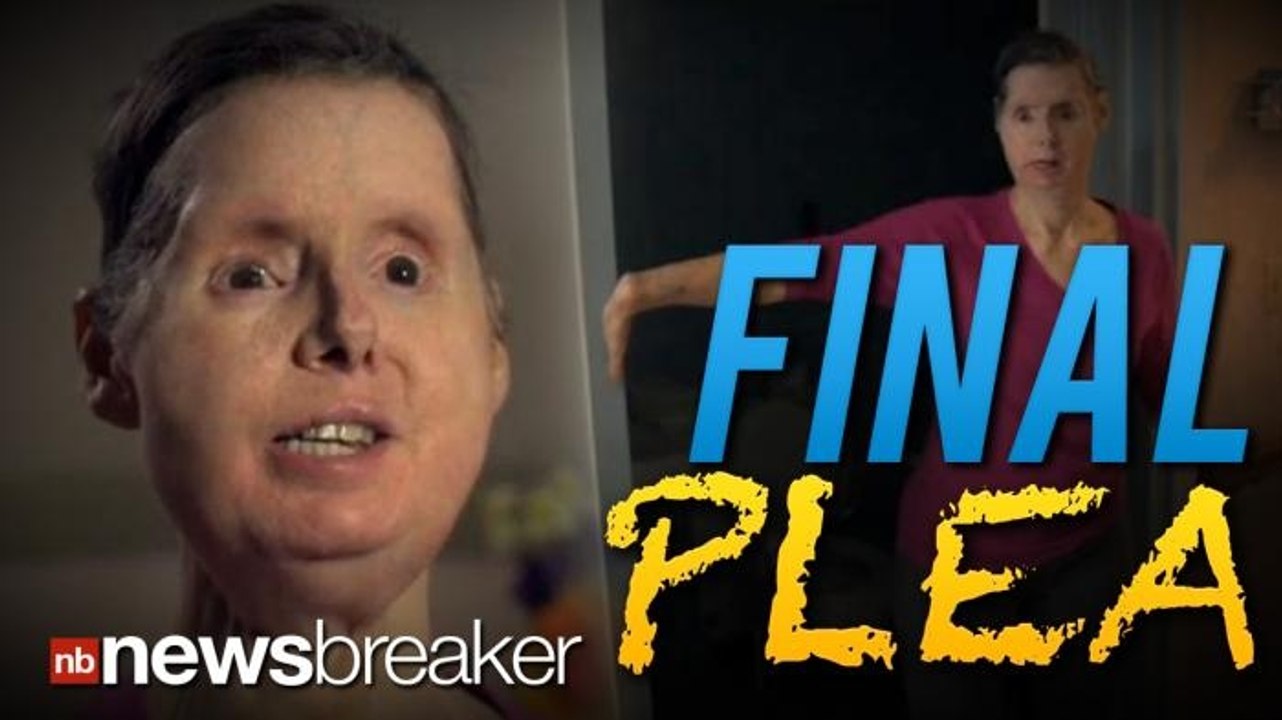 FINAL PLEA: Woman Mauled and Disfigured in Chimp Attack Pleads Lawmakers to Allow $150M Suit
