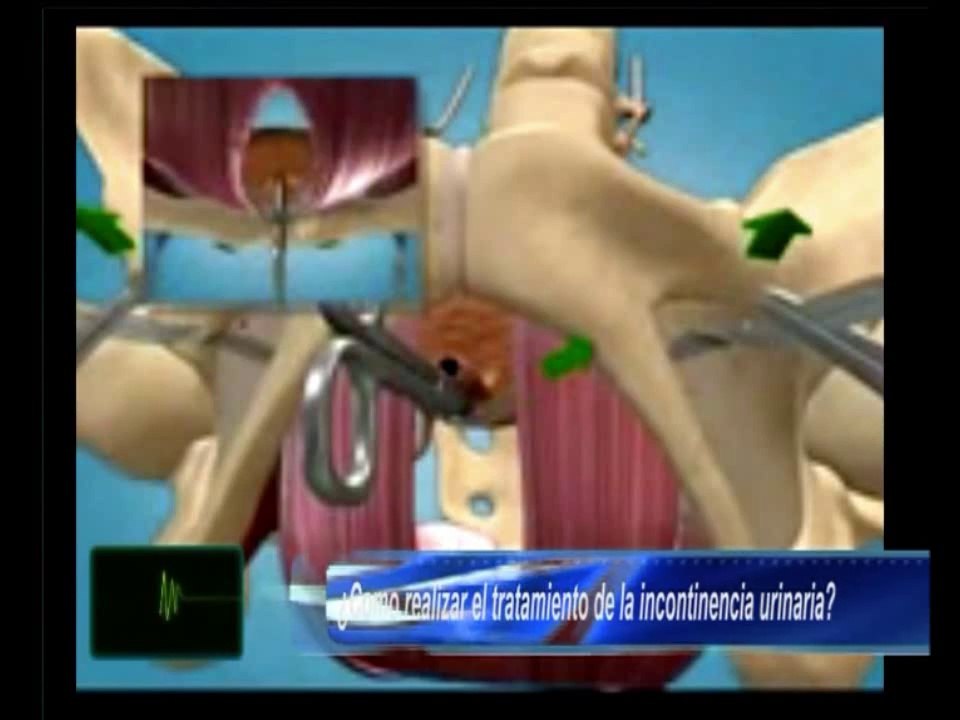 Dres Muller- Dominguez / Urodinamia