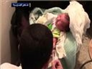 ظهور حالات إصابة بمرض السل بدير الزور