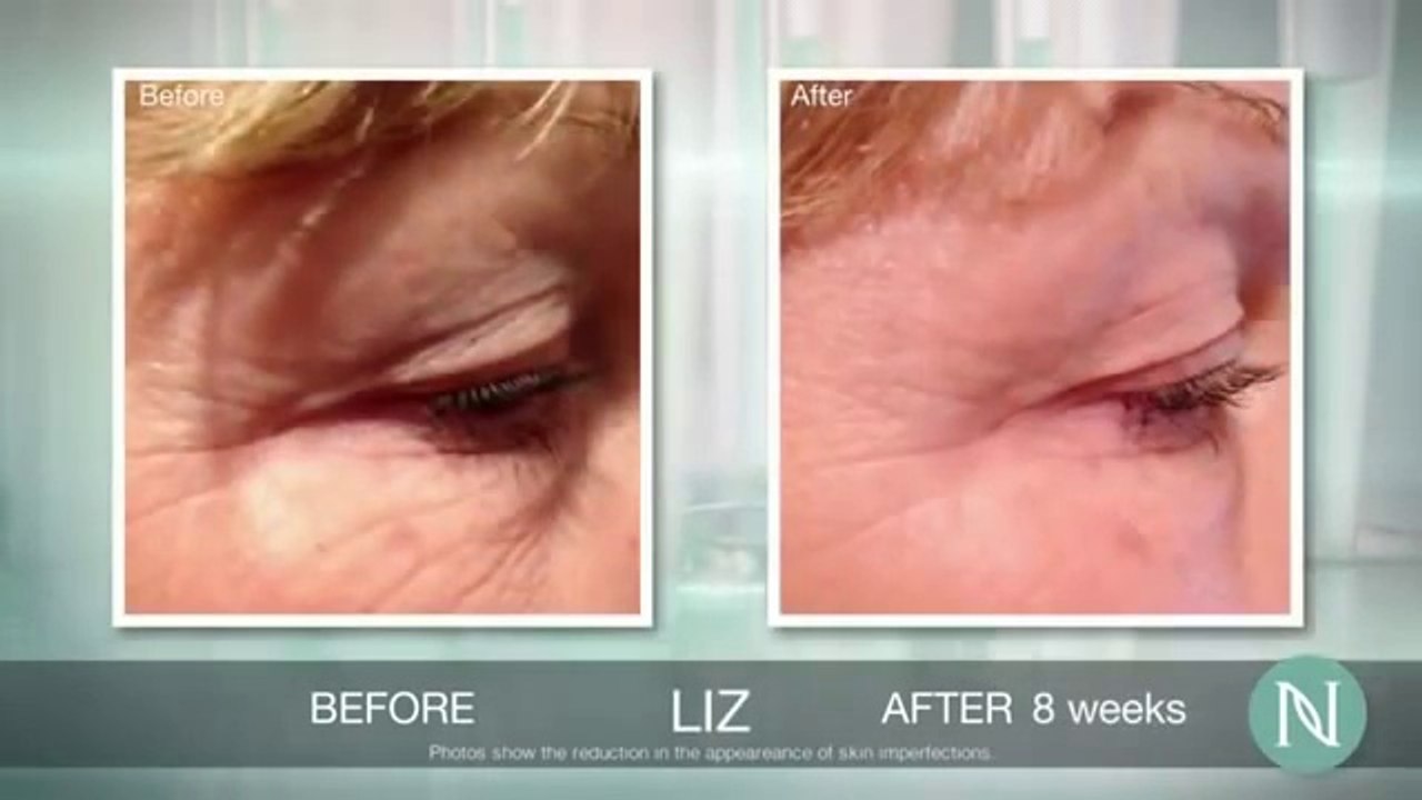 How to Purchase Nerium AD and Save $30 ! Nerium AD Review. Don't Purchase untill you See this ! WOW