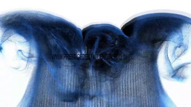 Cosmetic & General Dentistry Services Offered by Prestige Dental Implant Center in Colorado Springs & Pueblo