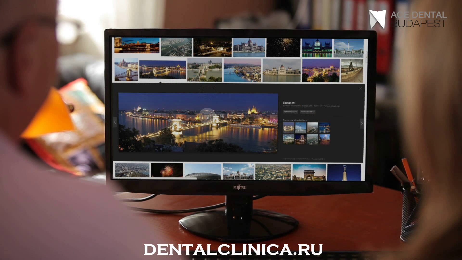 ⁣European Clinic of Aesthetic Dentistry in Budapest Имплантация протезирование пластическая хирургия 