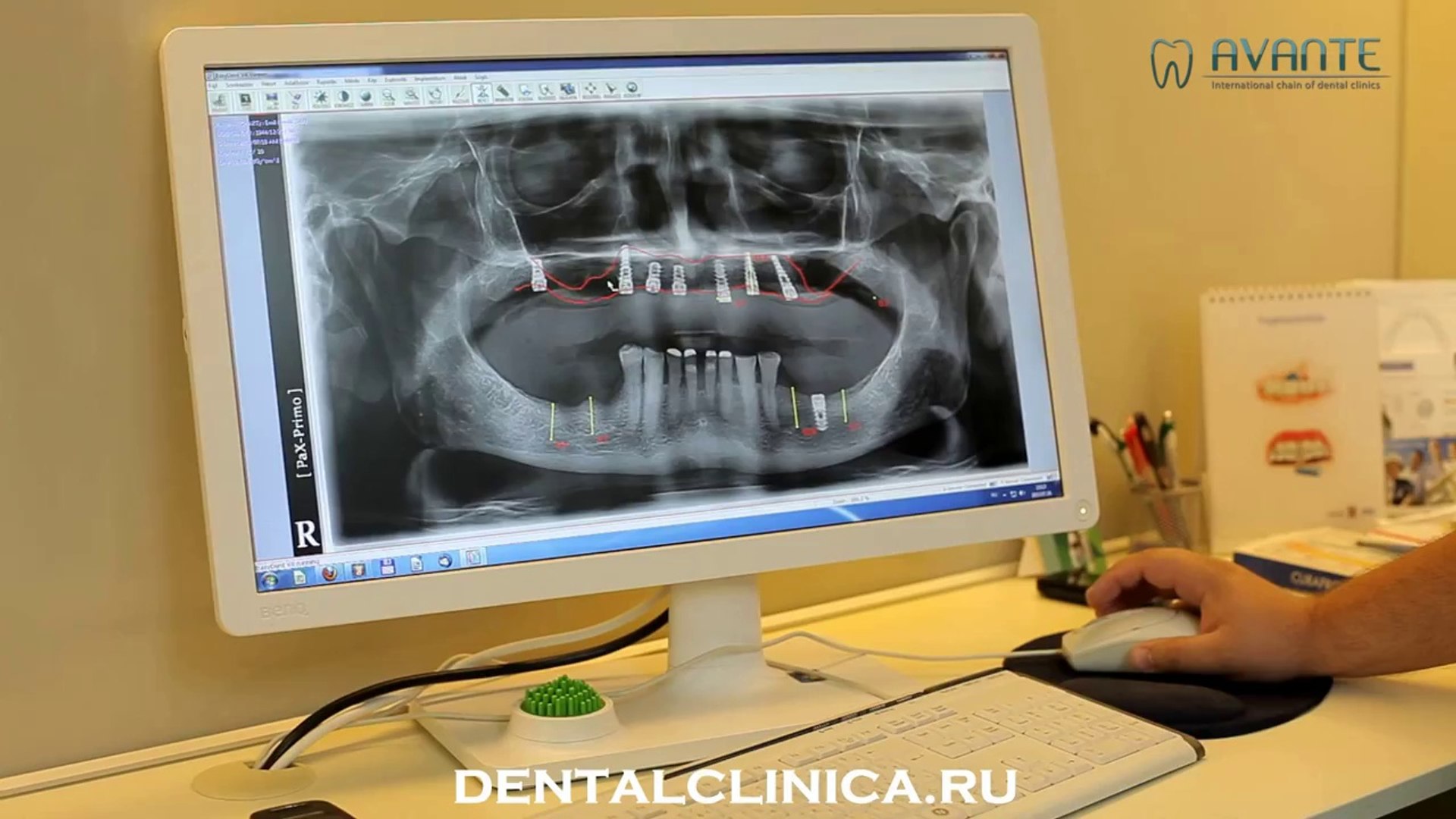 ⁣European Clinic of Aesthetic Dentistry in Budapest “Jewel Dental” “AVANTE” Клиника Стоматологии лече
