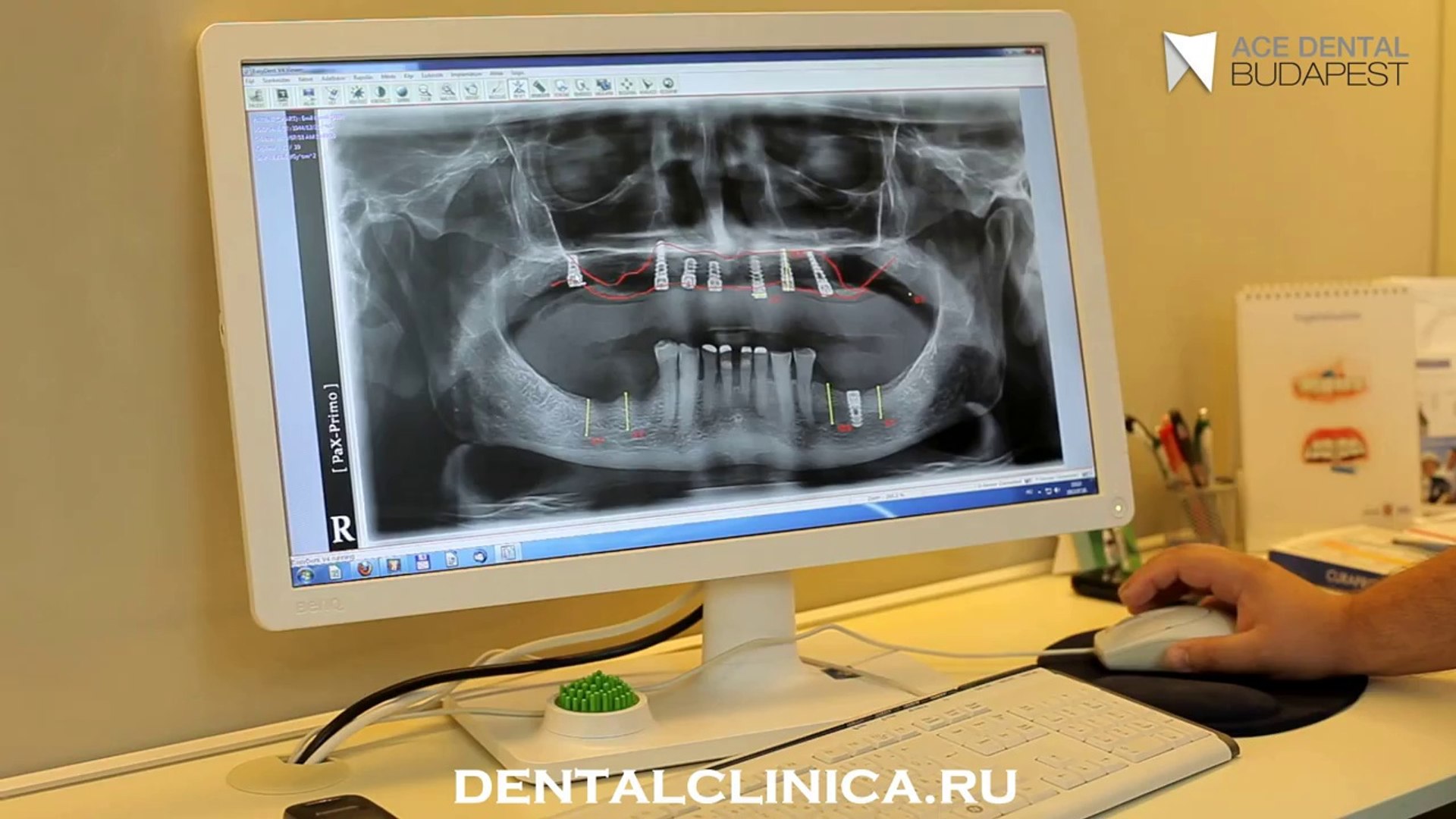 ⁣European Clinic of Aesthetic Dentistry in Budapest “Jewel Dental” “AVANTE” Клиника Стоматологии лече