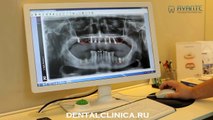 European Clinic of Aesthetic Dentistry in Budapest “Jewel Dental” “AVANTE” Стоматология лечение протезирование имплантация пластическая хирургия экспресс-терапия восполнение кости лечебный туризм здоровье отдых