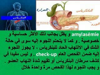 Les amylases et lipases - Pancréatite aigue