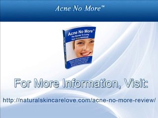 Diverse natural remedies for acne to clear your complexion completely