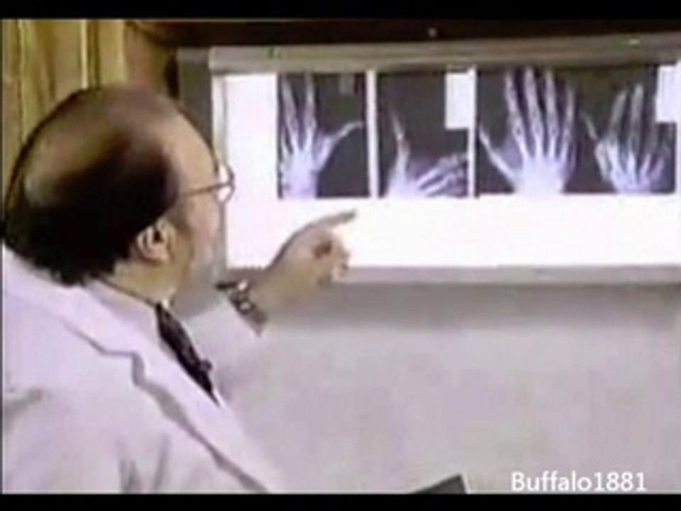 Implants extraterrestres ( partie 2 sur 2 )