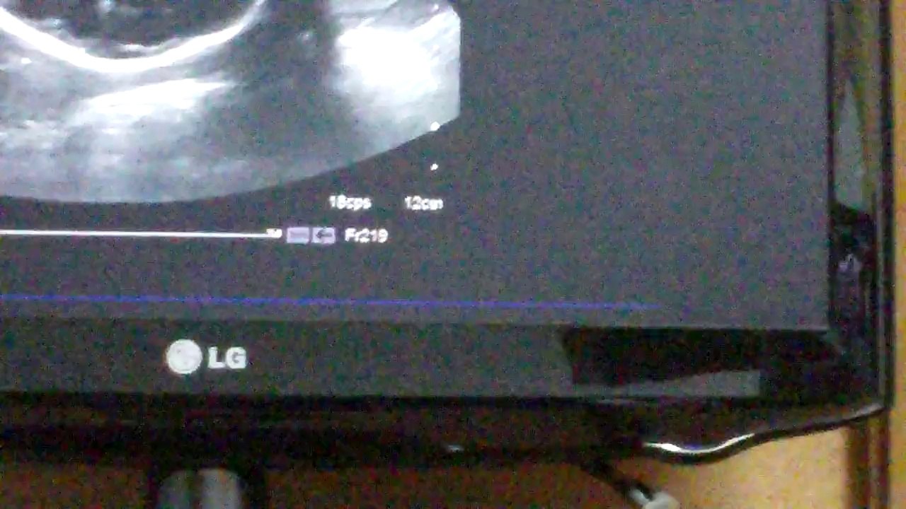 La bebesita de Ericka