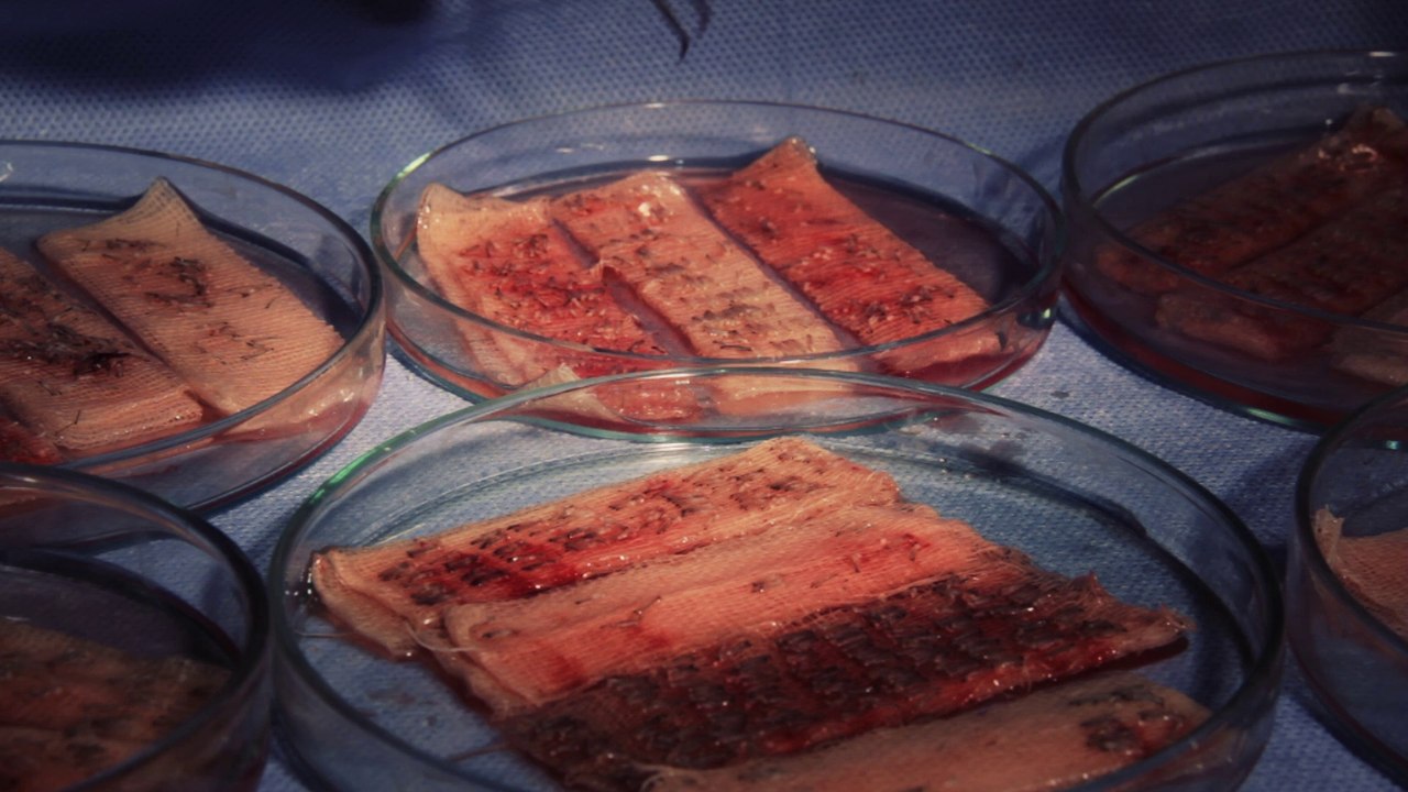 MEDEKS HAİR CENTER-HAARTRANSPLANTATİON-00905324048011