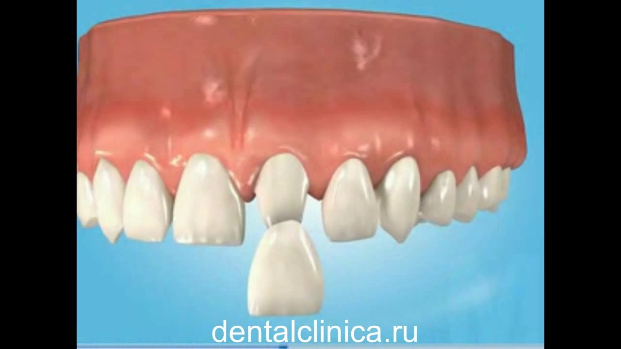 European Clinic of Aesthetic Dentistry Стоматология лечение протезирование имплантация пластическая хирургия экспресс-терапия восполнение кости лечебный туризм здоровье отдых