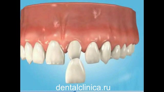 European Clinic of Aesthetic Dentistry Стоматология лечение протезирование имплантация пластическая хирургия экспресс-терапия восполнение кости лечебный туризм здоровье отдых