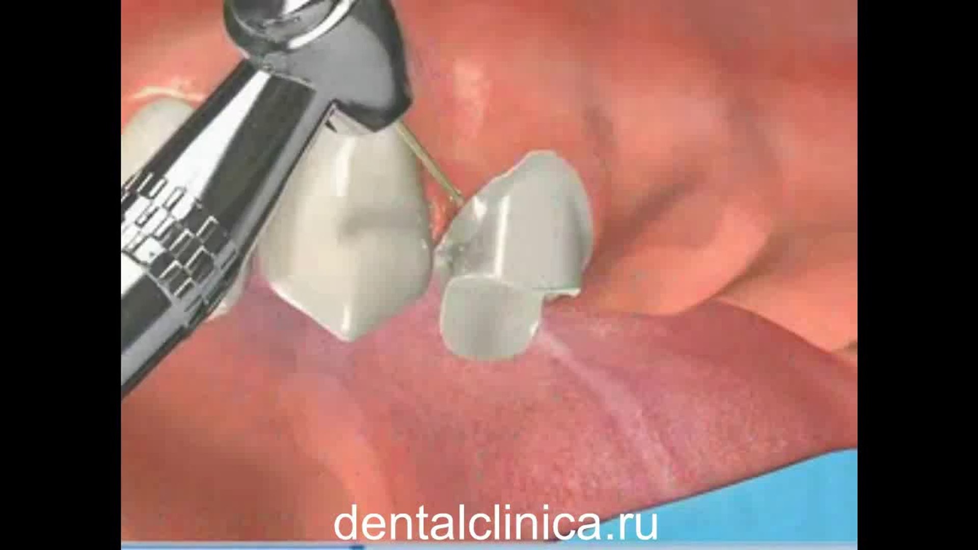 ⁣Международная клиника имплантологии эстетической стоматологии в Будапеште Профессиональное и доступн