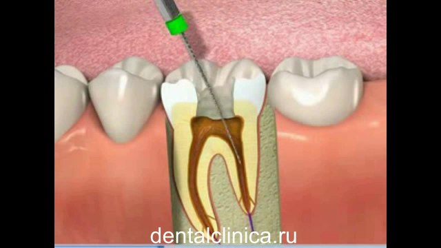 Международная клиника имплантологии эстетической стоматологии в Будапеште Профессиональное и доступное лечение зубов