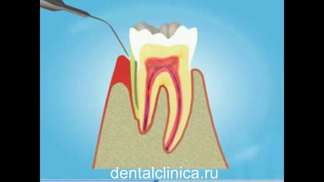 Стоматологические услуги, лечение зубов не дорого и качественно Международная клиника имплантологии эстетической стоматологии