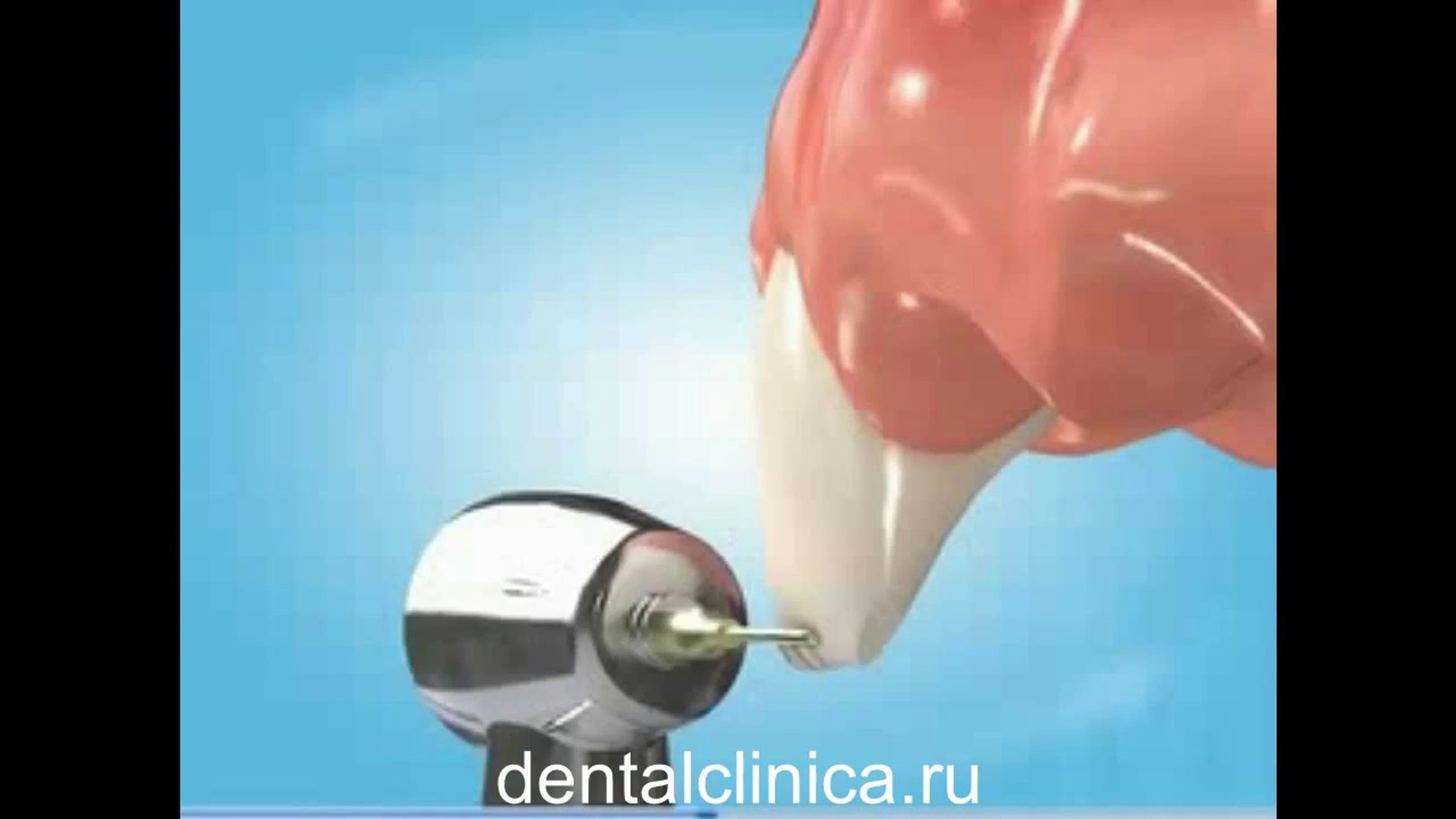 ⁣Стоматологические услуги, лечение зубов не дорого и качественно Международная клиника имплантологии 