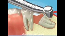 Стоматологические услуги, лечение зубов не дорого и качественно Международная клиника имплантологии эстетической стоматологии