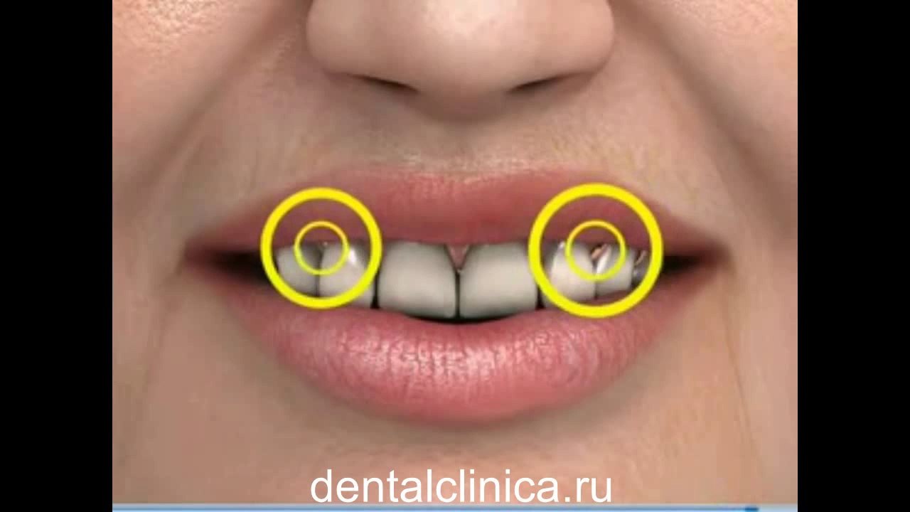 Стоматологические услуги, лечение зубов не дорого и качественно Международная клиника имплантологии эстетической стоматологии