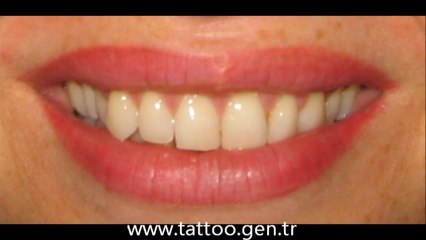 dudak-makyaji-tattoo.gen.tr