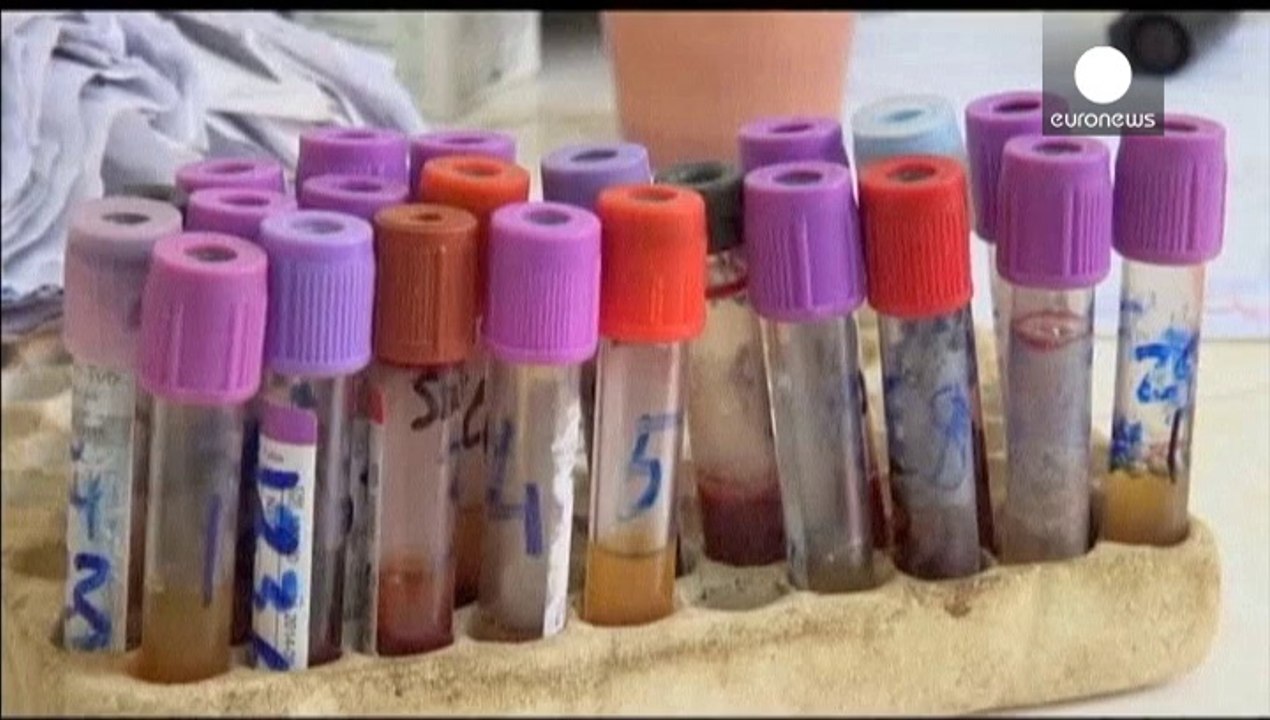 Eviter la propagation du virus Ebola en Afrique