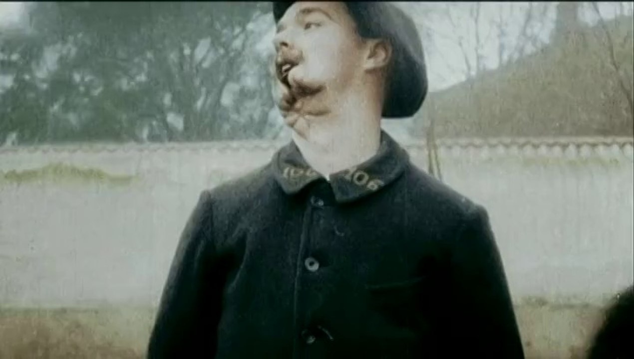 "Apocalypse, la première guerre mondiale" : les "gueules cassées"