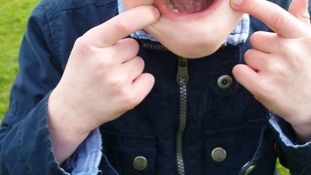 Boy Shows No Fear as Helicopter Takes His Tooth Out