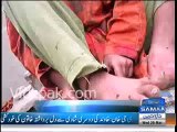 Mentally disable children are being kept in chains by Parents in Rajanpur