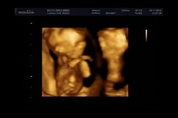 Ощущения на 13 неделе беременности