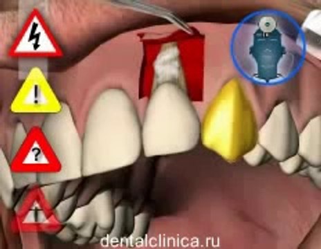 Международная клиника имплантологии эстетической стоматологии в Будапеште Профессиональное и доступное лечение зубов