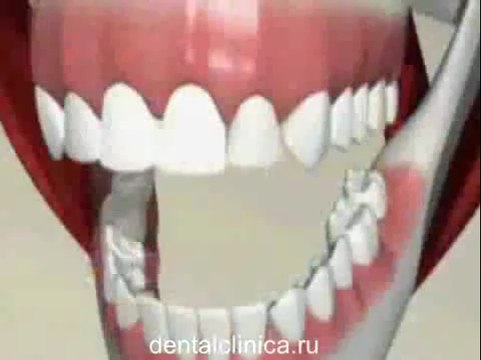 Стоматологические услуги, лечение зубов не дорого и качественно Международная клиника имплантологии эстетической стоматологии