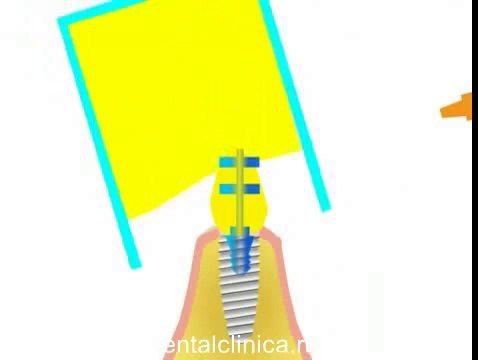 Стоматологические услуги, лечение зубов не дорого и качественно Международная клиника имплантологии эстетической стоматологии