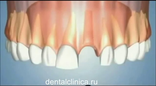 Международная клиника имплантологии эстетической стоматологии в Будапеште Профессиональное и доступное лечение зубов