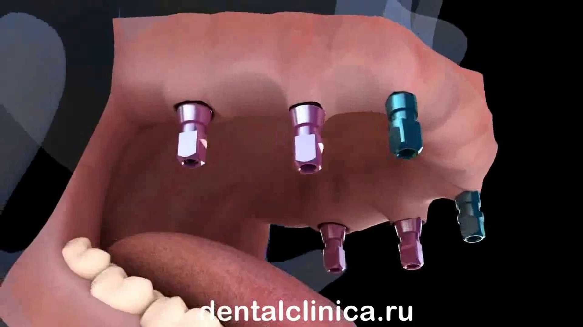 ⁣European Clinic of Aesthetic Dentistry in Budapest “Jewel Dental” “AVANTE” Dentist Medical Center Ле