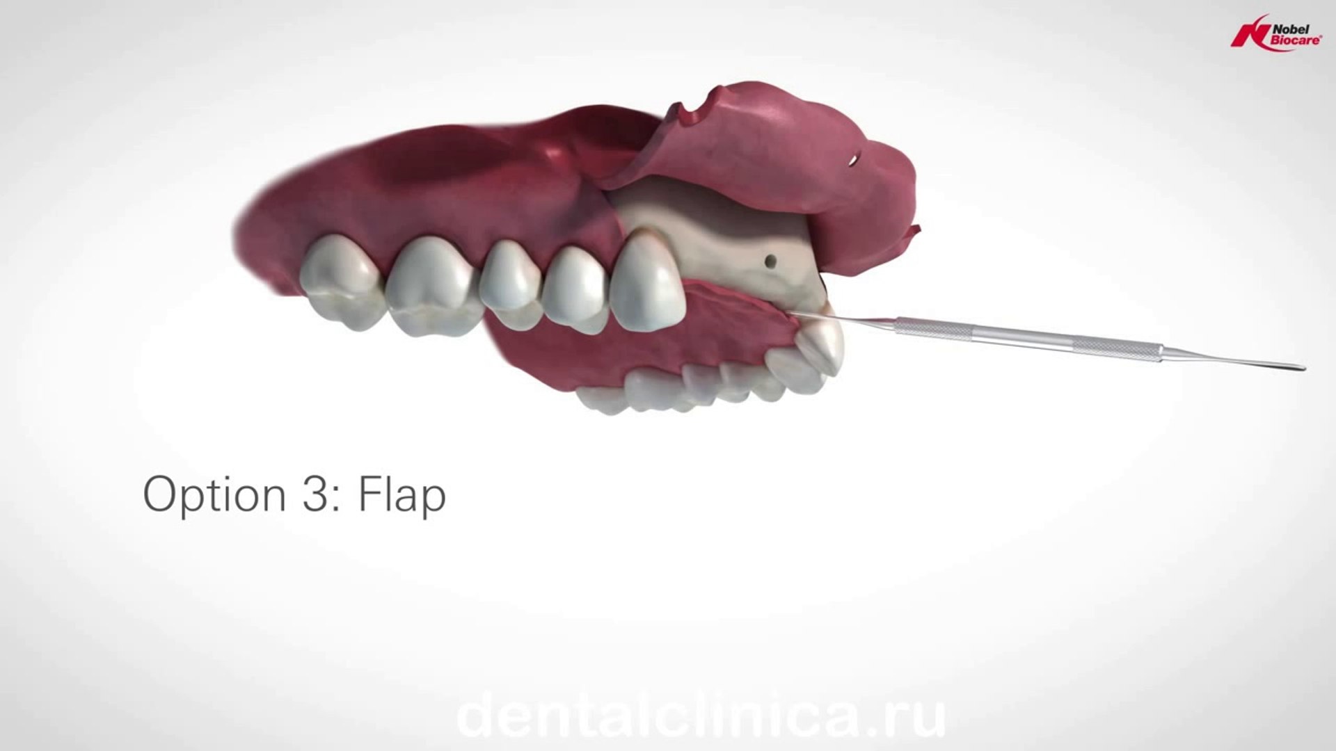 ⁣European Clinic of Aesthetic Dentistry Лечение зубов красивая улыбка коронка циркониевая металлокера