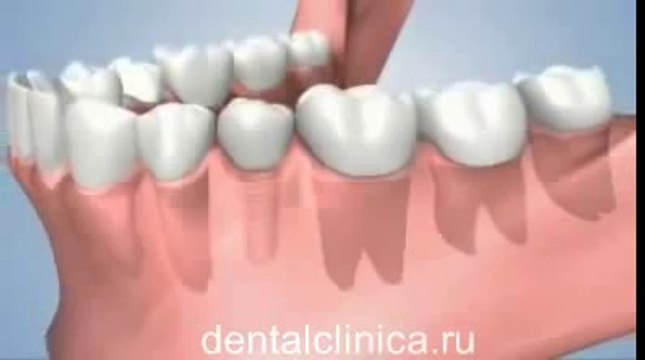 European Clinic of Aesthetic Dentistry Стоматология лечение протезирование имплантация пластическая хирургия экспресс-терапия восполнение кости лечебный туризм здоровье отдых