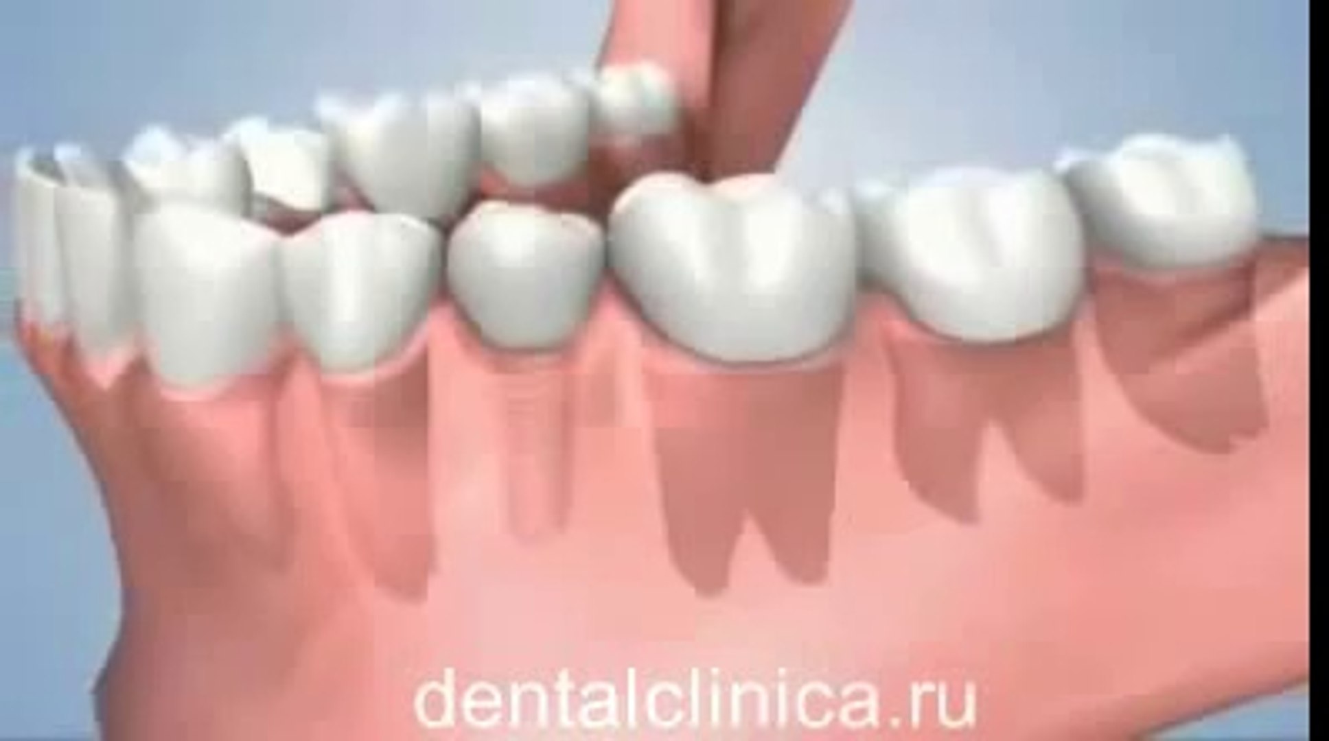 ⁣European Clinic of Aesthetic Dentistry Стоматология лечение протезирование имплантация пластическая 