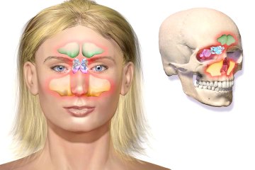 Conozca cómo se diagnostica la obstrucción nasal y sus implicaciones