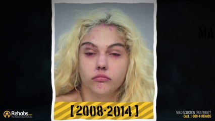 Avant / Après : Visage de drogué