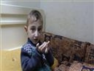 عكرمة.. مريض العظم الزجاجي