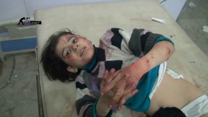 شـــــام میں ایک زخمی بچی درد میں بھی اللہ کو پکار رہی ھــــے