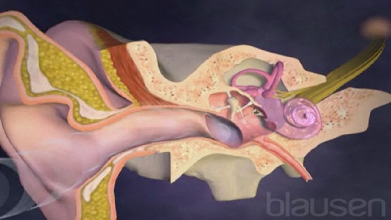Implant cochélaire