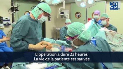 Une prothèse de crâne en 3D implantée avec succès