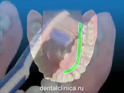 European Clinic of Aesthetic Dentistry Стоматология лечение зубов в Санкт-Петербурге Москве имплантация европейское качество низкие цены протезирование туризм отдых