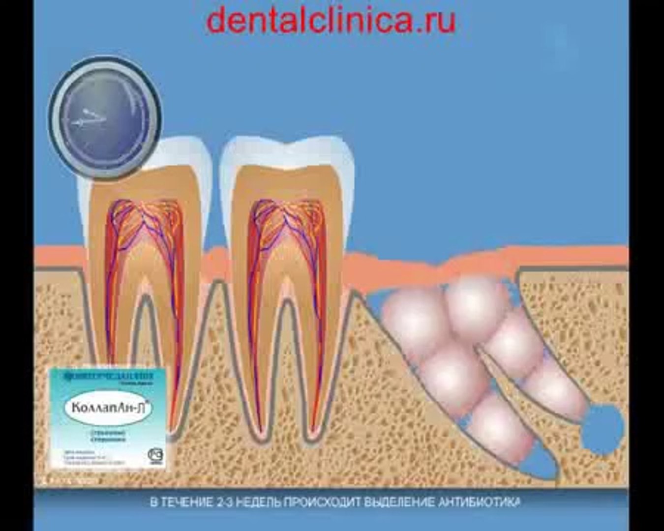 ⁣European Clinic of Aesthetic Dentistry Стоматология лечение зубов в Санкт-Петербурге Москве импланта