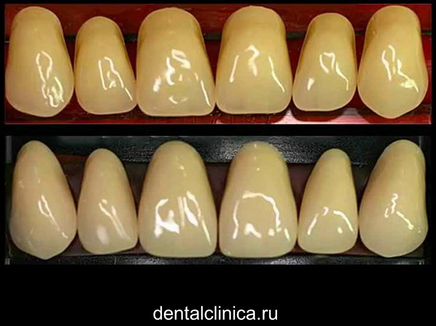 European Clinic of Aesthetic Dentistry Стоматология лечение зубов имплантация европейское качество н