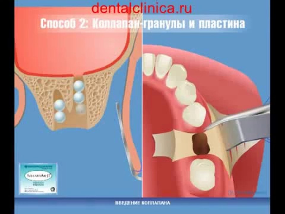 European Clinic of Aesthetic Dentistry Стоматология лечение зубов имплантация европейское качество низкие цены протезирование туризм путешествия отдых