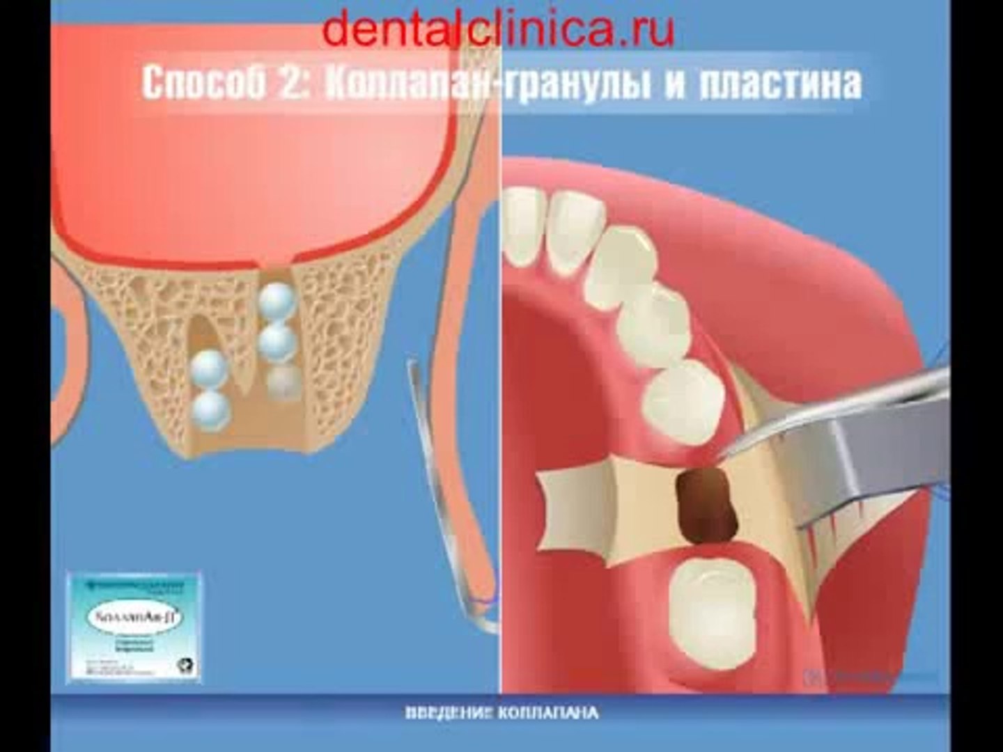 European Clinic of Aesthetic Dentistry Стоматология лечение зубов имплантация европейское качество н