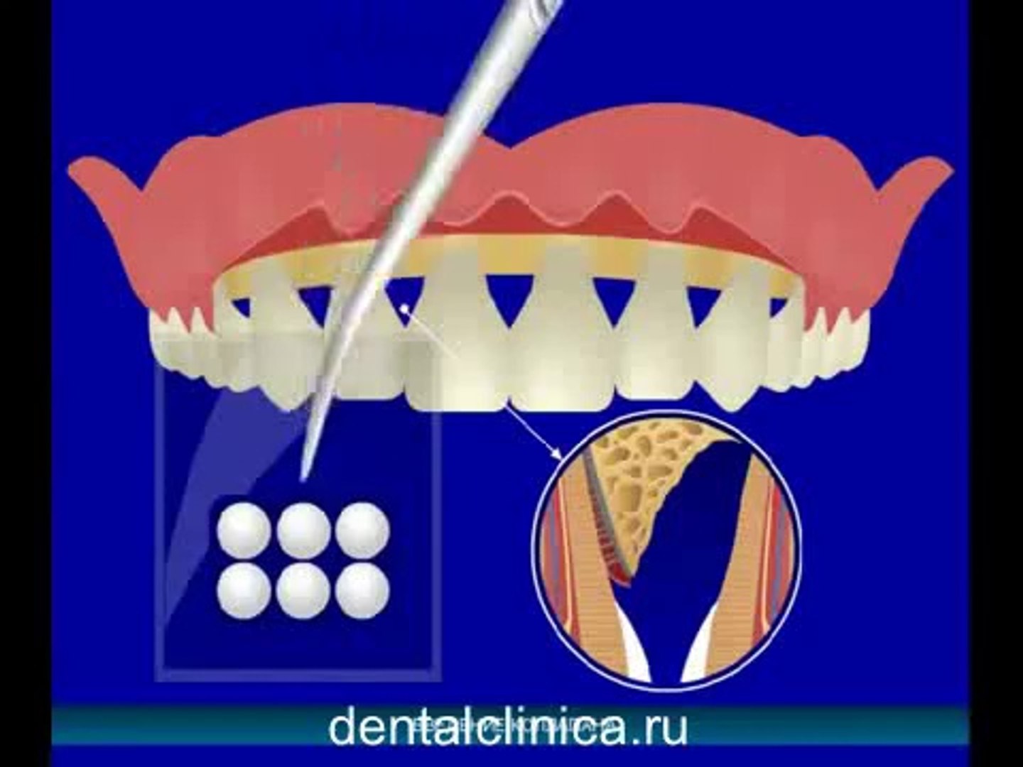 European Clinic of Aesthetic Dentistry Стоматология лечение зубов имплантация европейское качество н