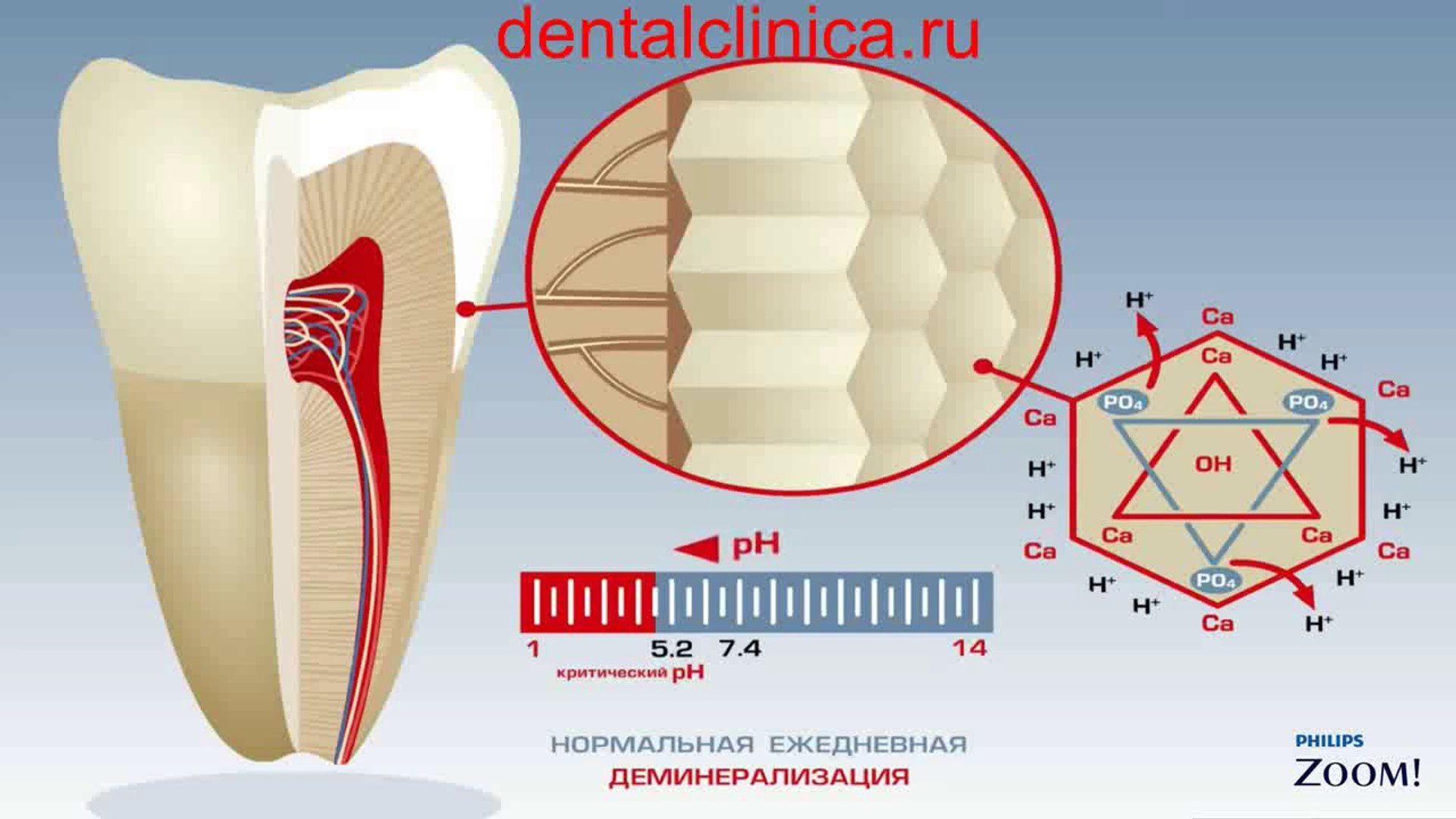 European Clinic of Aesthetic Dentistry in Budapest Стоматология лечение зубов имплантация европейско